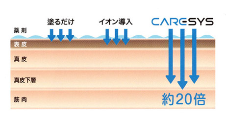 薬剤を注射することなく導入
